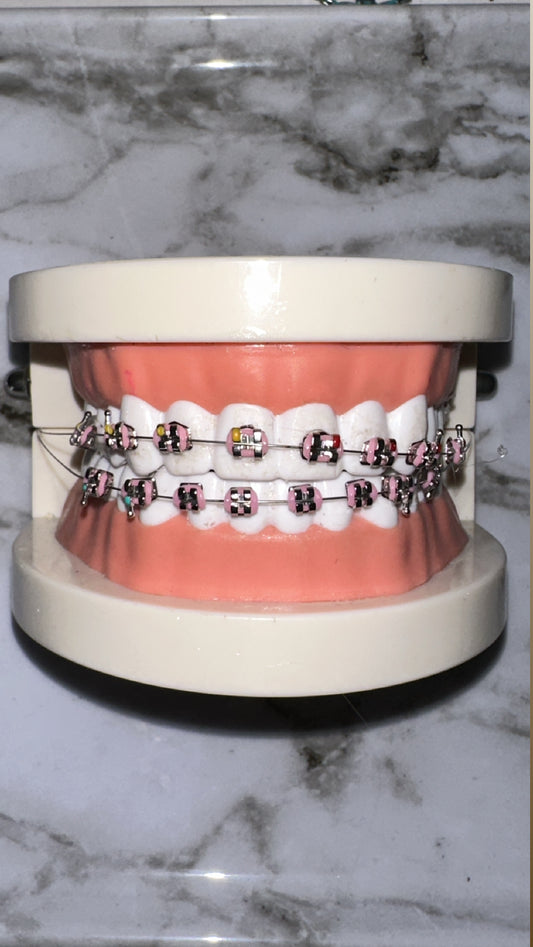 ALL around regular brace 10 BRACKETS teeth model
